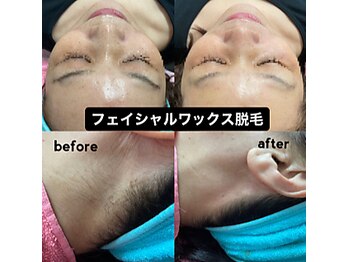 ヘアファッション ユミ(HAIR FASHION YUMI)/顔waxとうなじwax脱毛
