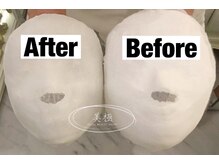 美極 銀座店/銀座/小顔コルギ/小顔矯正