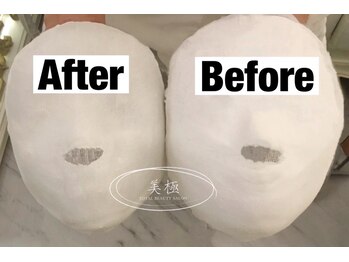 美極 銀座店/銀座/小顔コルギ/小顔矯正