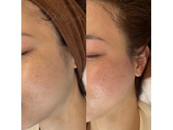 ベルアイラッシュ(Belleyelash)/【フェイシャルワックス】