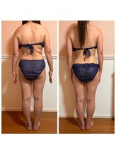 トータル フィルシャイン(Total Fillshine)/本気痩せ全身コース3回