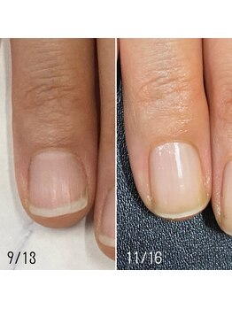 ネイルズ アヴァンティ(Nails Avanti)/最強のネイルケア3ヶ月コース