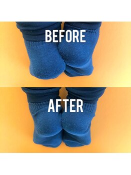 整体サロン佑/たった1回の施術で！