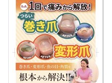 巻き爪補正店 鹿児島店