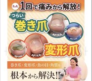 巻き爪補正店 鹿児島店