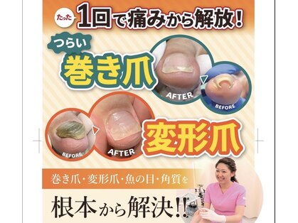 巻き爪補正店 鹿児島店の写真