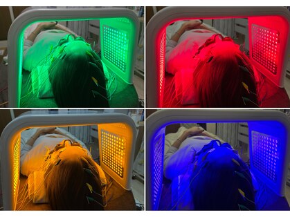 ミモザ(mimosa)の写真