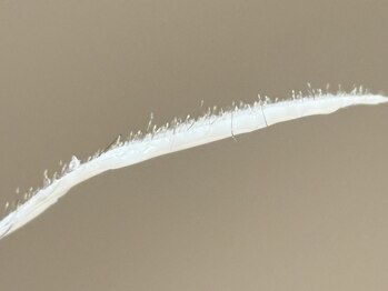 ミア(miiia)の写真/【フェイスWAX】お顔の産毛&角質ケアでトーンUP♪さらにリフトUPまで叶える◎顔ダニも除去しニキビケアも!