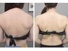 【☆背中のニキビや浮腫の改善！】コラーゲン導入＋Wキャビで美背中に  ￥7700