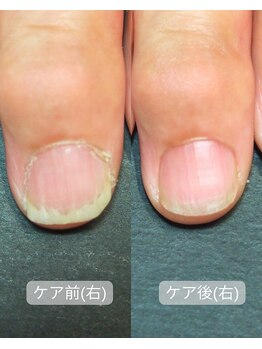 キラリネイル(KIRARINAIL)/お客さまの変化