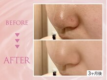 クリアラボ 川崎(Clear Lab)/韓国式肌管理&毛穴洗浄専門店