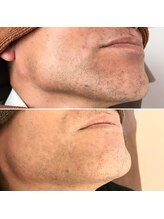 スリーク(SREEK)/脱毛も身だしなみのひとつ