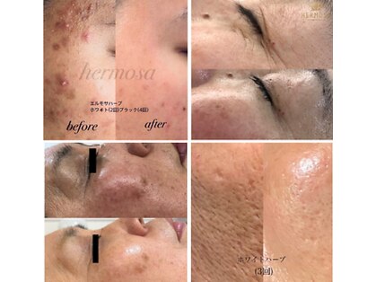 アジュール(a jour)の写真