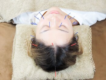 ジェネラス 鍼灸院 整骨院(GENEROUS)/顔へ鍼