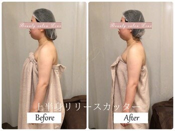 リノ(Lino)/上半身リリースカッターB&A