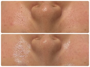 エフェクト 塚口店(effect)/before after