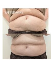 エステティック ザザ 神楽坂店(ZA/ZA)/ACエンマボディ