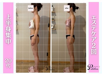 プルクレ 常磐町店(Pulchre)/ボディケアで小顔に♪