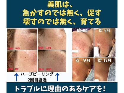 ピュアビューティー(Pure Beauty)の写真