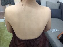 ヌー(Nu.)/ウェディングボディメイク施術後