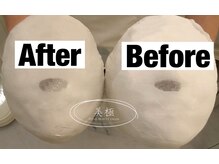 美極 銀座店/銀座/小顔コルギ/小顔矯正