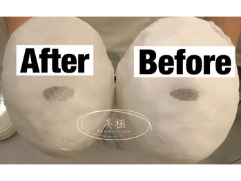 美極 銀座店/銀座/小顔コルギ/小顔矯正