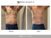 ユー(U)/筋膜リリース