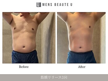 ユー(U)/筋膜リリース