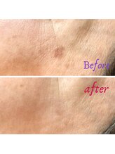 ラディアント 吉祥寺/あるのと無いのとでこんなに違う