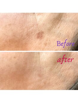 ラディアント 吉祥寺/あるのと無いのとでこんなに違う