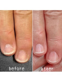 ネイルズ アヴァンティ(Nails Avanti)/スペシャルネイルケア