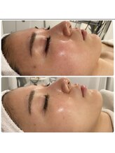 アイラッシュ アンド リラクゼーション ヘアー(eyelash&relaxation Hair)/光フォト