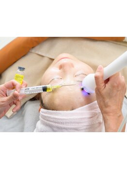 シミしわ改善！予防ケア