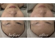 サロン ビュー(salon view)/ダクトピール/ビフォーアフター