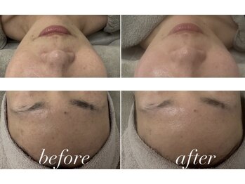 サロン ビュー(salon view)/ダクトピール/ビフォーアフター