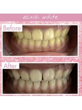 エクシアホワイト 長野店/