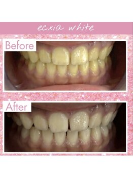 エクシアホワイト 長野店/