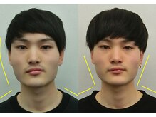 宮崎整体院/【美容整体】全身根本改善コース