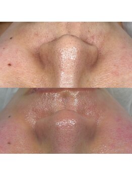 サロン クベル(Salon Kvell)/フェイスワックス