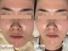 コモレビ(komorebi)/くすみオフ・明るい肌へ♪