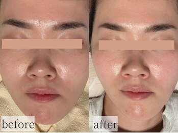 コモレビ(komorebi)/くすみオフ・明るい肌へ♪