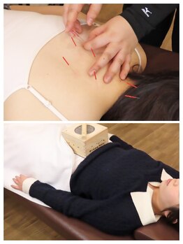 セイコツスタジオ 観音寺(SEIKOTSU STUDIO)の写真/国家資格者が在籍！女性施術者による鍼灸体験で、諦めていた『とれない痛み』や深層筋のコリにサヨナラ！