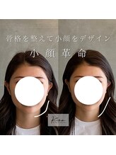 コア 中目黒店(Koa)/お客様ビフォーアフター！！