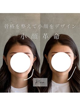 コア 中目黒店(Koa)/お客様ビフォーアフター!!