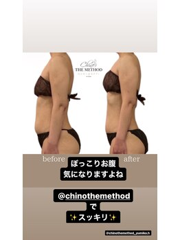 アジャストメント ナチュラル(adjustment natural)/Before&After