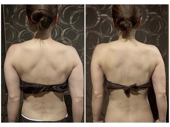 ヴィヴィエ 佐賀店(ViVier)/肩甲骨剥がし