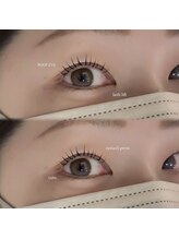 ルーフアイ(ROOF EYE)/ROOF EYE(ルーフ アイ)