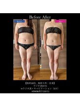 フェレザ 新潟(Felleza)/新潟-痩身エステ-BODYエステ