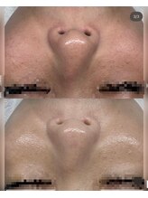 ビューティーホームサロン(Beauty Home Salon)/ノーファンデアンプル