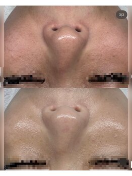 ビューティーホームサロン(Beauty Home Salon)/ノーファンデアンプル